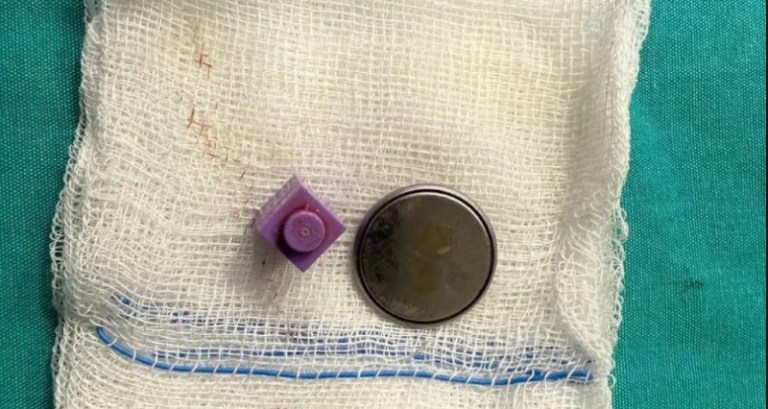 Kayseri’de 15 Aylık Bebeğin Hayatı Kurtarıldı!